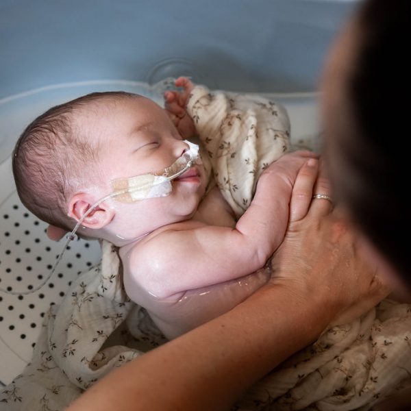 Thérapeutique Bain Bébé - bébé de 3 semaines souriant dans le bain, avec sonde nasale dans le nez.